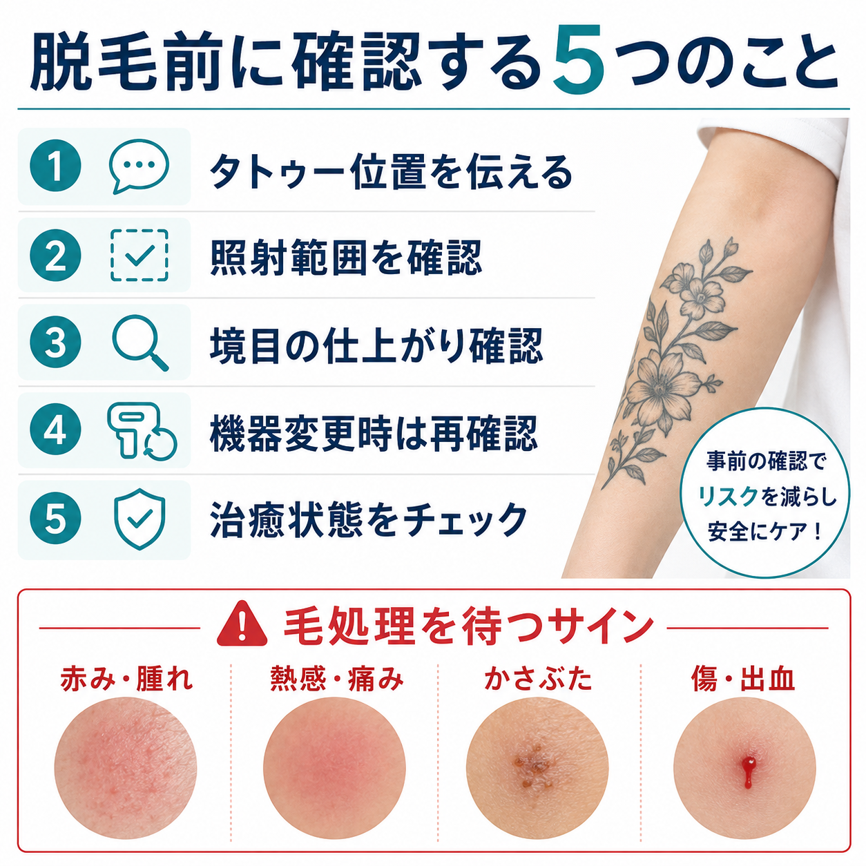 タトゥーがある場合の毛処理方法の比較