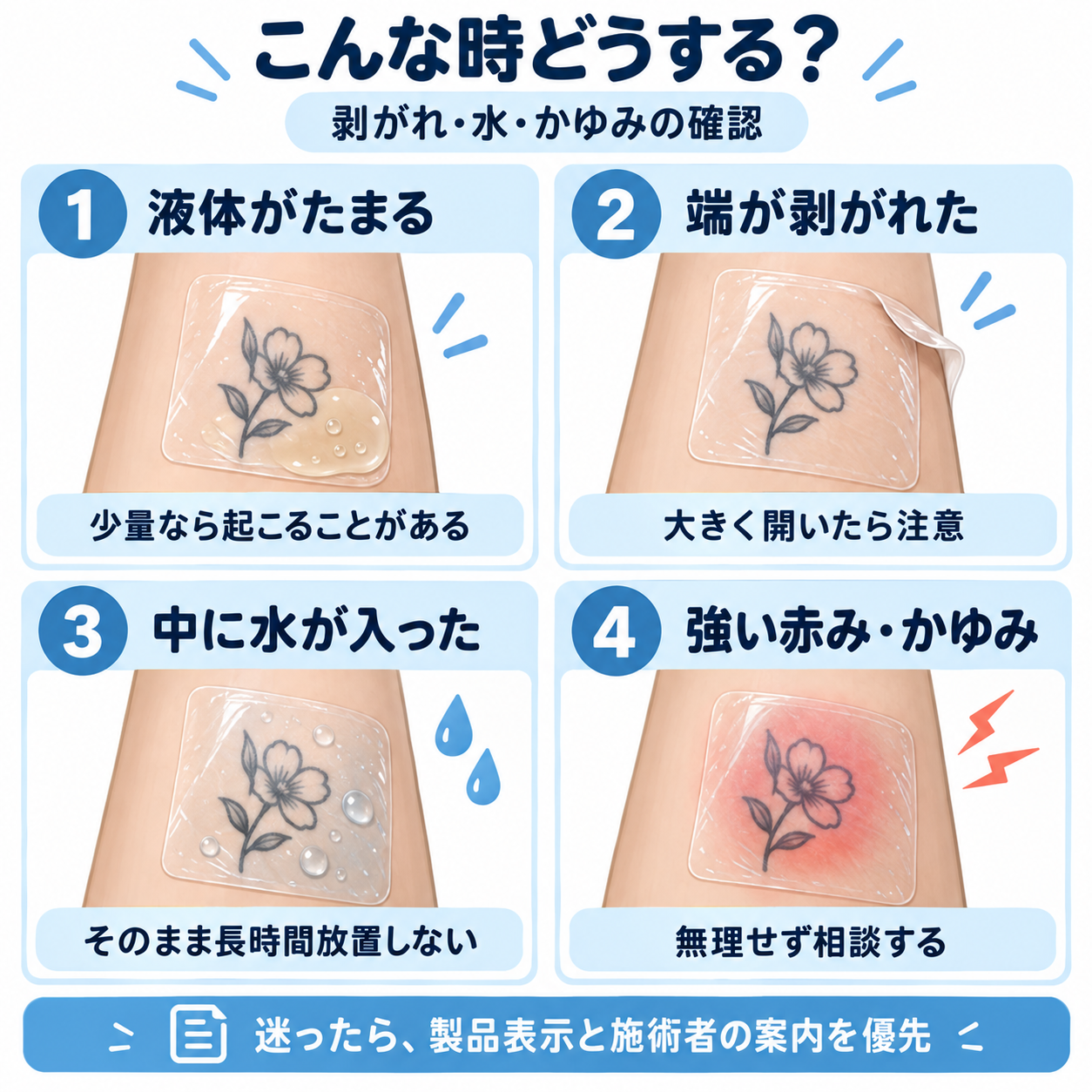 タトゥー保護フィルムの剥がれ・水・赤み・かゆみの確認ポイント